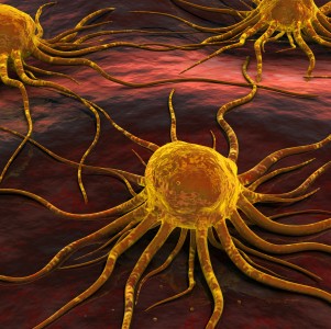 Is your weight loss plan giving you cancer?