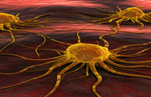 Major study finds that cancer screening programs don't extend life